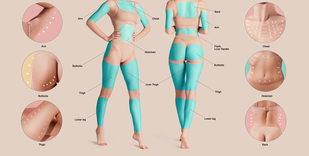 Poster,With,Female,Body,With,Marked,Areas,For,Lifting,Procedures.