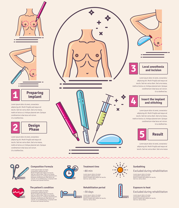 Ensemble d'illustrations vectorielles avec chirurgie d'augmentation mammaire. Infographies avec icônes de procédures de chirurgie plastique.