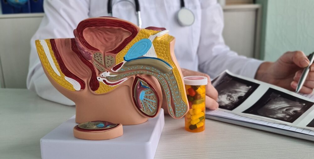 A close-up view of a medical office featuring a detailed anatomical model of the male reproductive system on a desk. The model displays internal structures like the prostate, bladder, and penis. Beside it, there is a prescription bottle with pills and ultrasound images, with a doctor in a white coat holding a pen in the background.